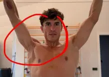 MotoGP 2026. Marc Márquez ci ha mostrato com'è messa davvero la sua spalla destra